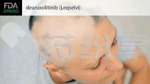 2024081903183555352